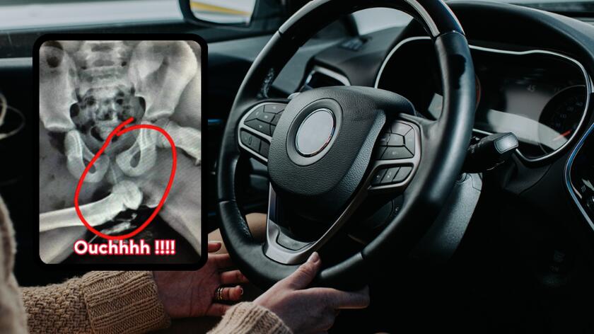 kierownica w samochodzie, zdjęcie rentgenowskie