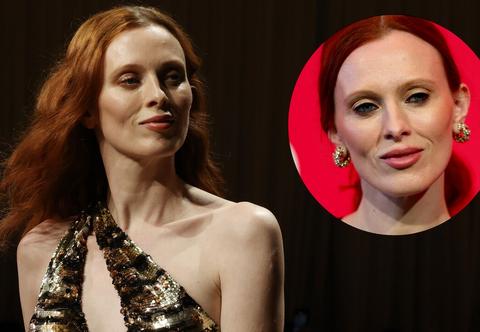 Supermodelka ujawnia kulisy nieudanego zabiegu medycyny estetycznej. "Błagałam, żeby przestali"