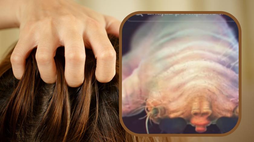 To grozi Ci, jeśli nie myjesz regularnie włosów