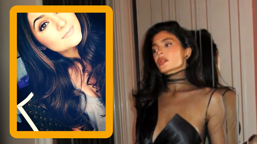 Kylie Jenner - przed i po