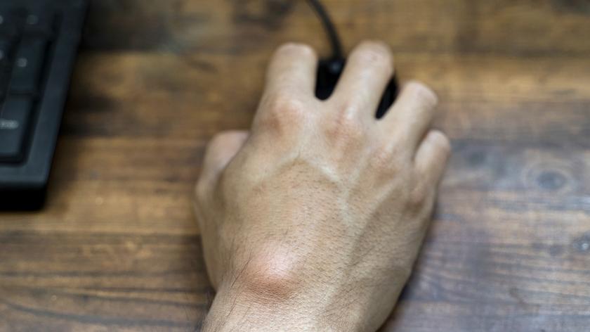 Męska dłoń z ganglionem trzymająca myszkę od komputera