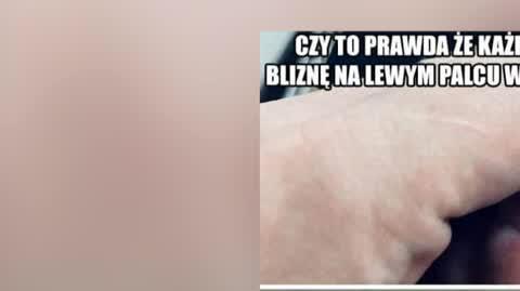 DD_20230124_Blizna_REP