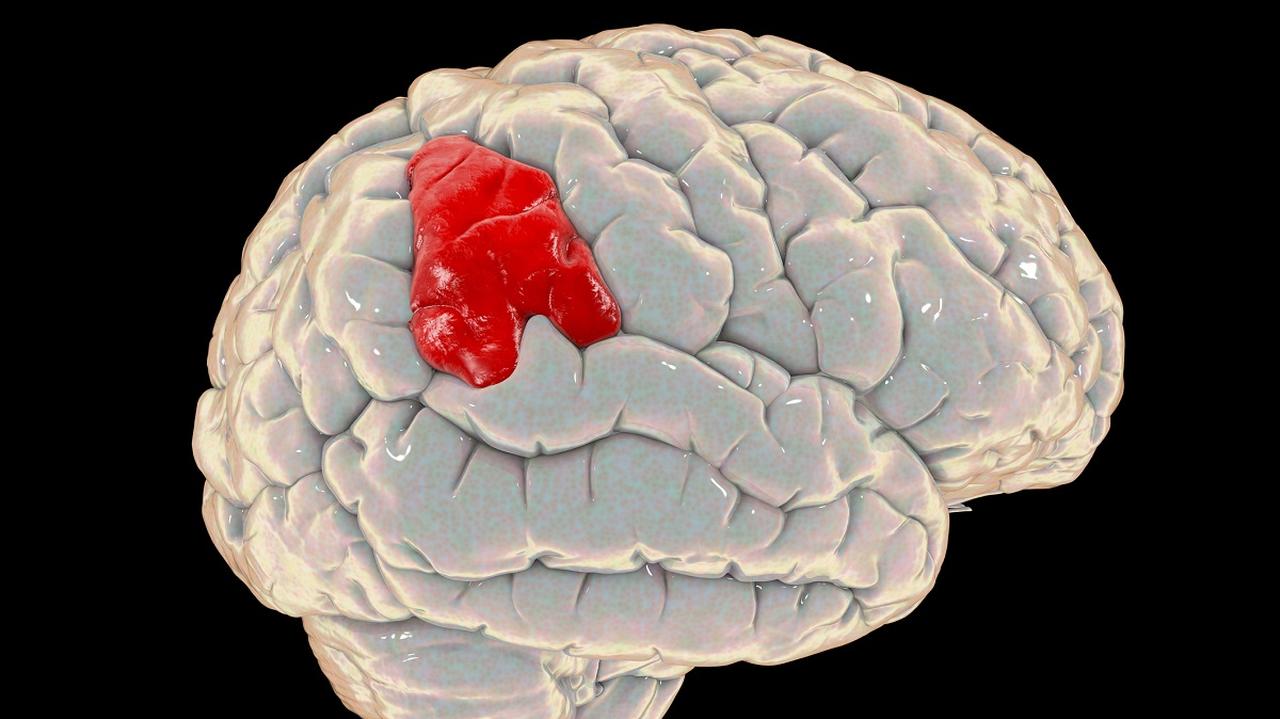 Model mózgu, zaznaczony obszar dotyczący afazji