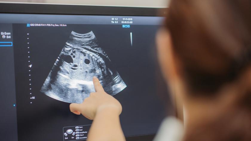 Lekarka, sprzęt do USG, ciąża