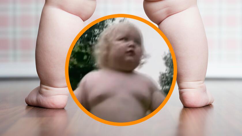 Noworodek urodził się z otyłością