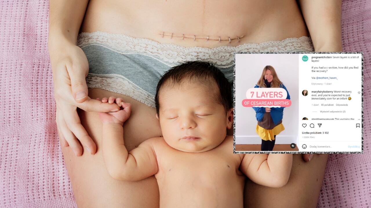 Kobieta z cesarskim cięciem i niemowlęciem na brzuchu
