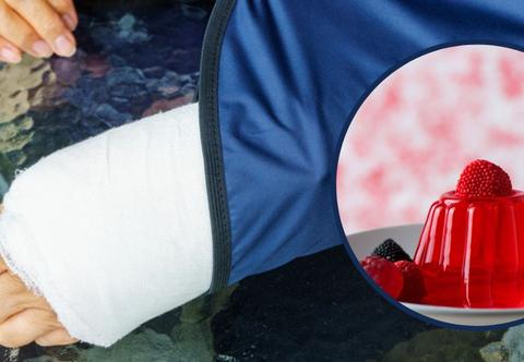 Co jeść przy złamaniu kości? Galaretka to nie najlepszy pomysł