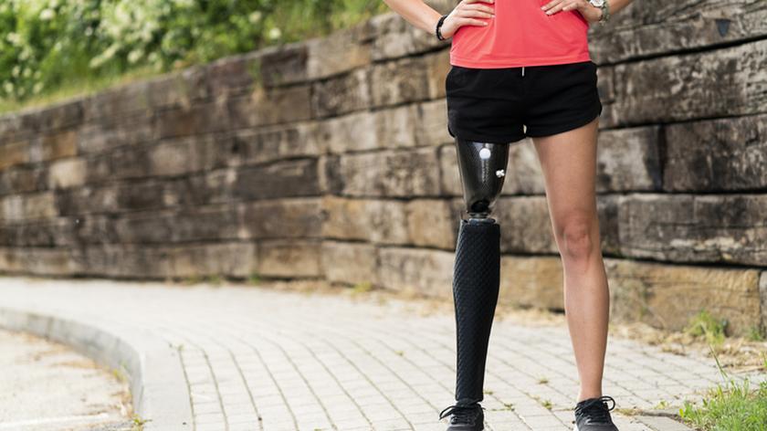 Kobieta z protezą prawej nogi. Amputacja nogi, choroba nowotworowa