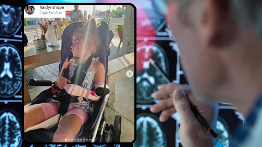 Lekarz ogląda rentgen mózgu