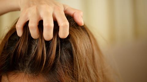 Trichodynia - czy włosy mogą boleć? Jak leczyć tę chorobę?